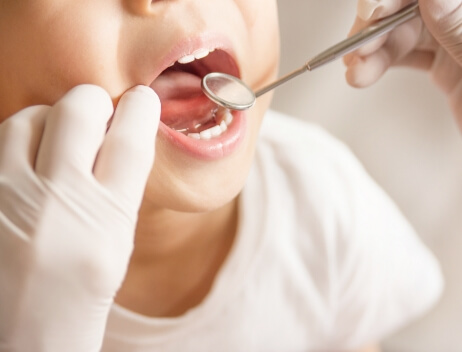 歯並び・永久歯の管理イメージ